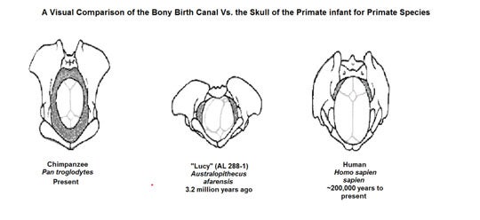 The shape of the pelvis had to change from accommodating quadrupedal motion, as seen on the left, to bipedal motion, as seen on the right, but there still had to be room for big-headed babies to be birthed. Image by ArchaeoMouse.