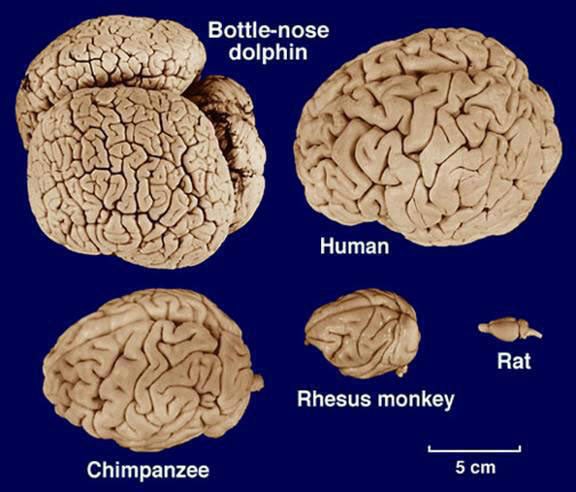 human brains