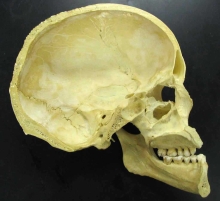 A human skull cut in half