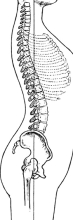 Lumbar lordosis